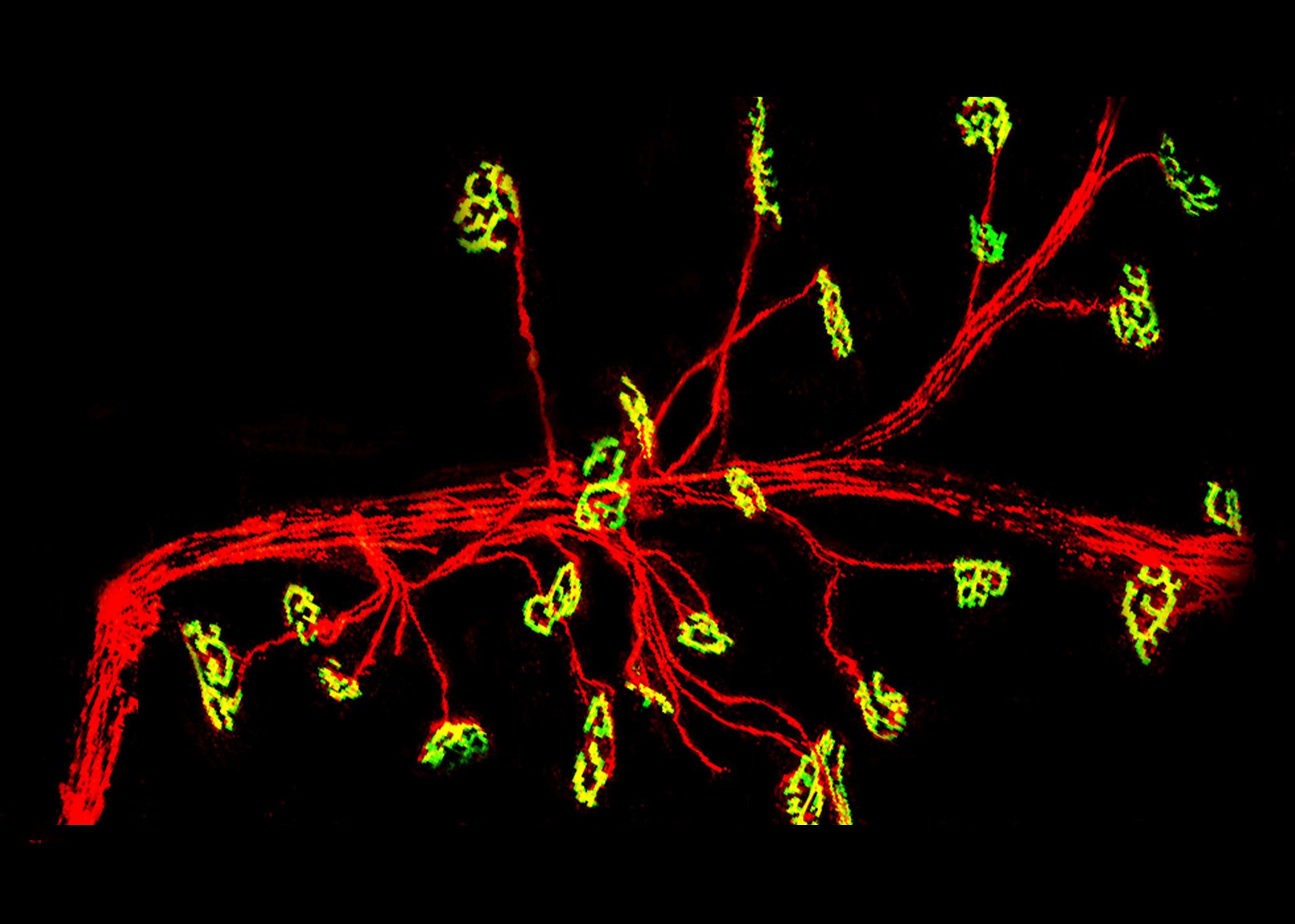 neuromuscular junction 